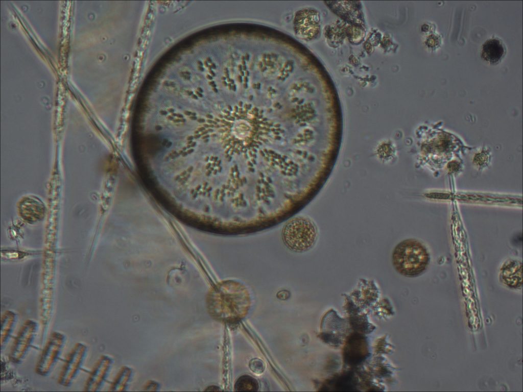 Diatoms are microscopic algae that come in all different shapes and sizes. (photo courtesy of Adrian Marchetti)